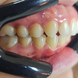 CASOS CLINICOS DE SUCESSO